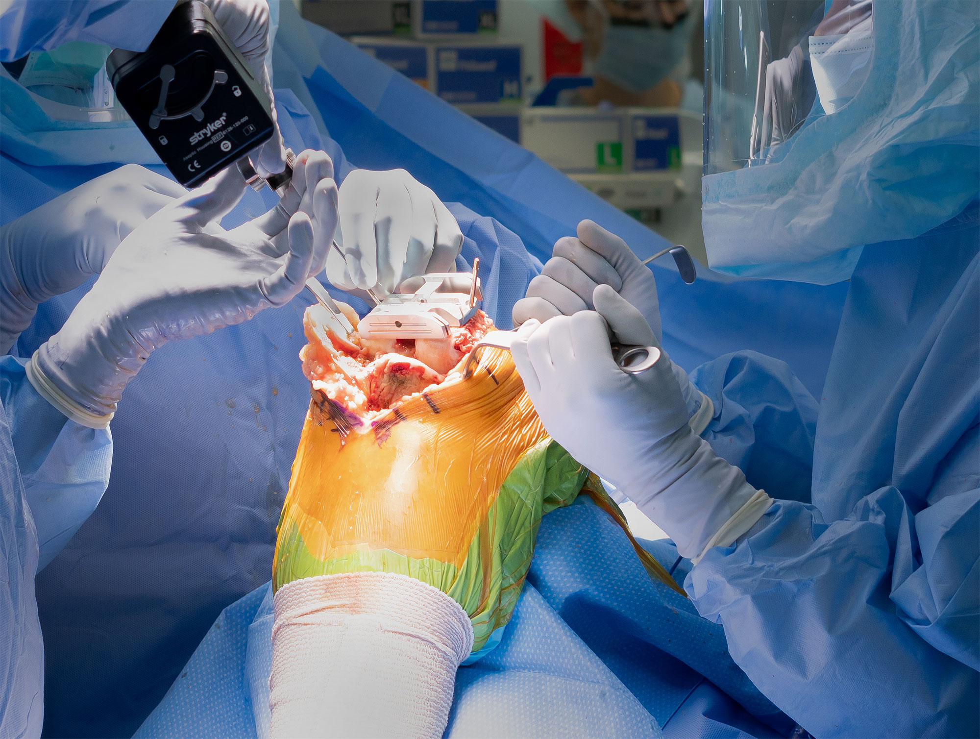 Knee Replacement Surgery